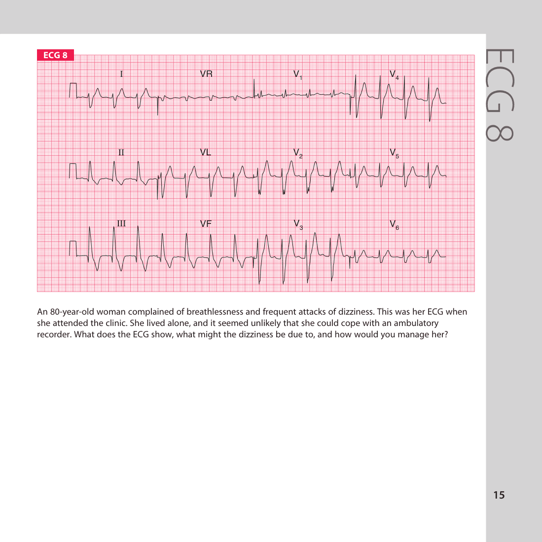 ECG 8