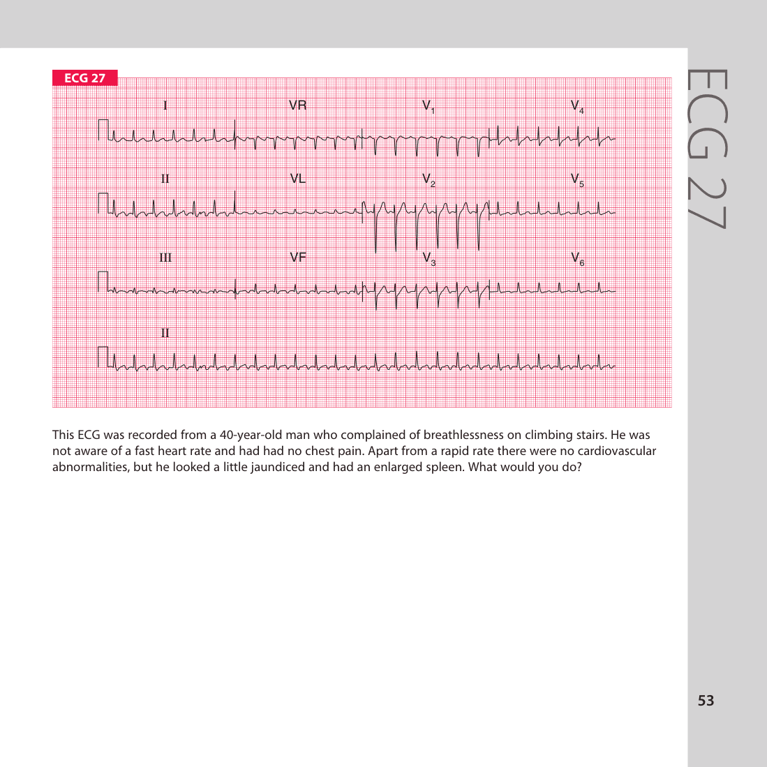 ECG 27