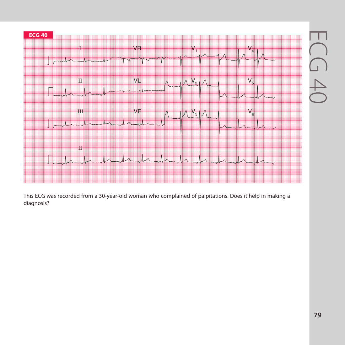 ECG 40
