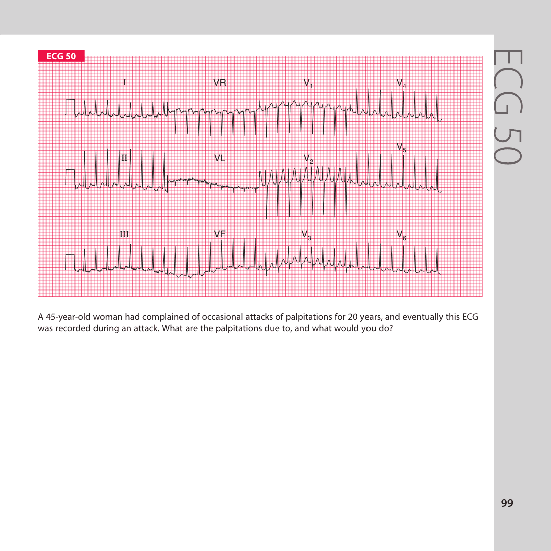ECG 50
