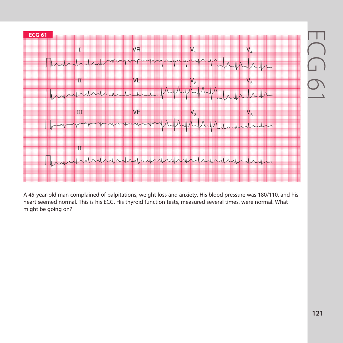 ECG 61