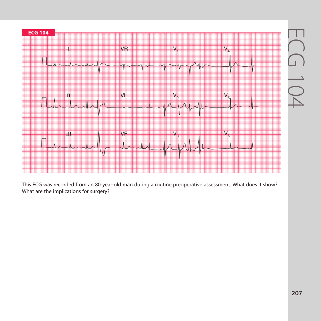 ECG 104