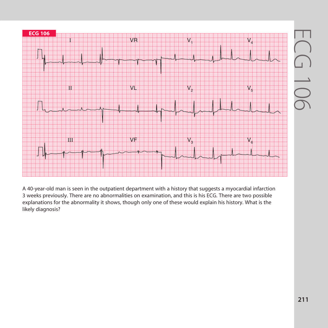 ECG 106