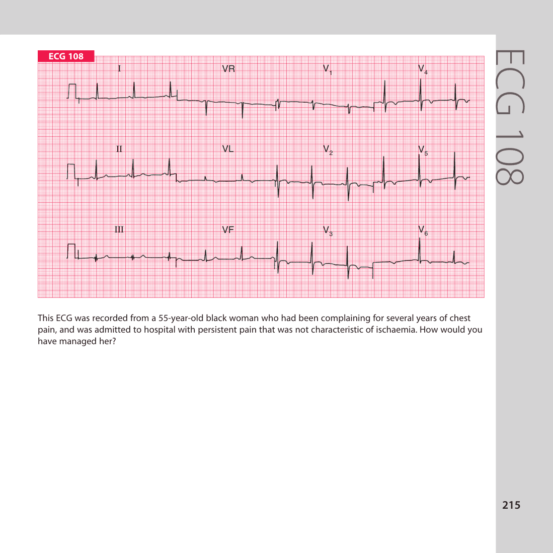 ECG 108