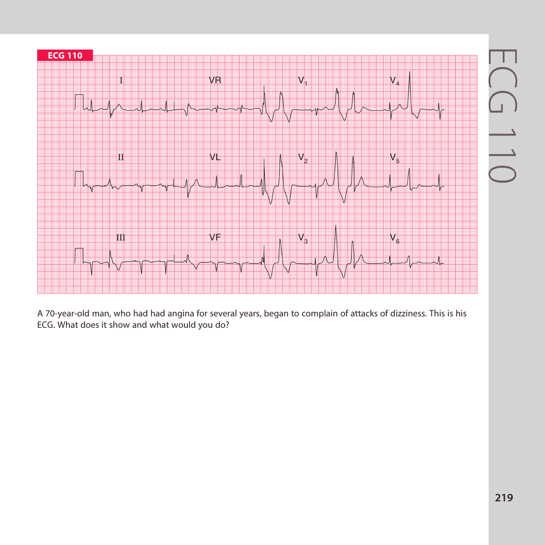 ECG 110