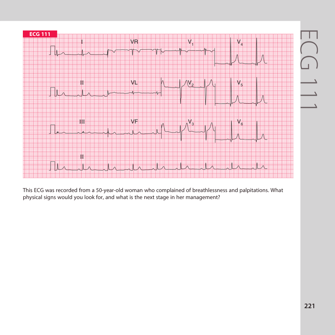 ECG 111