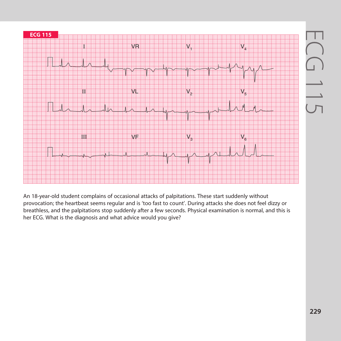 ECG 115
