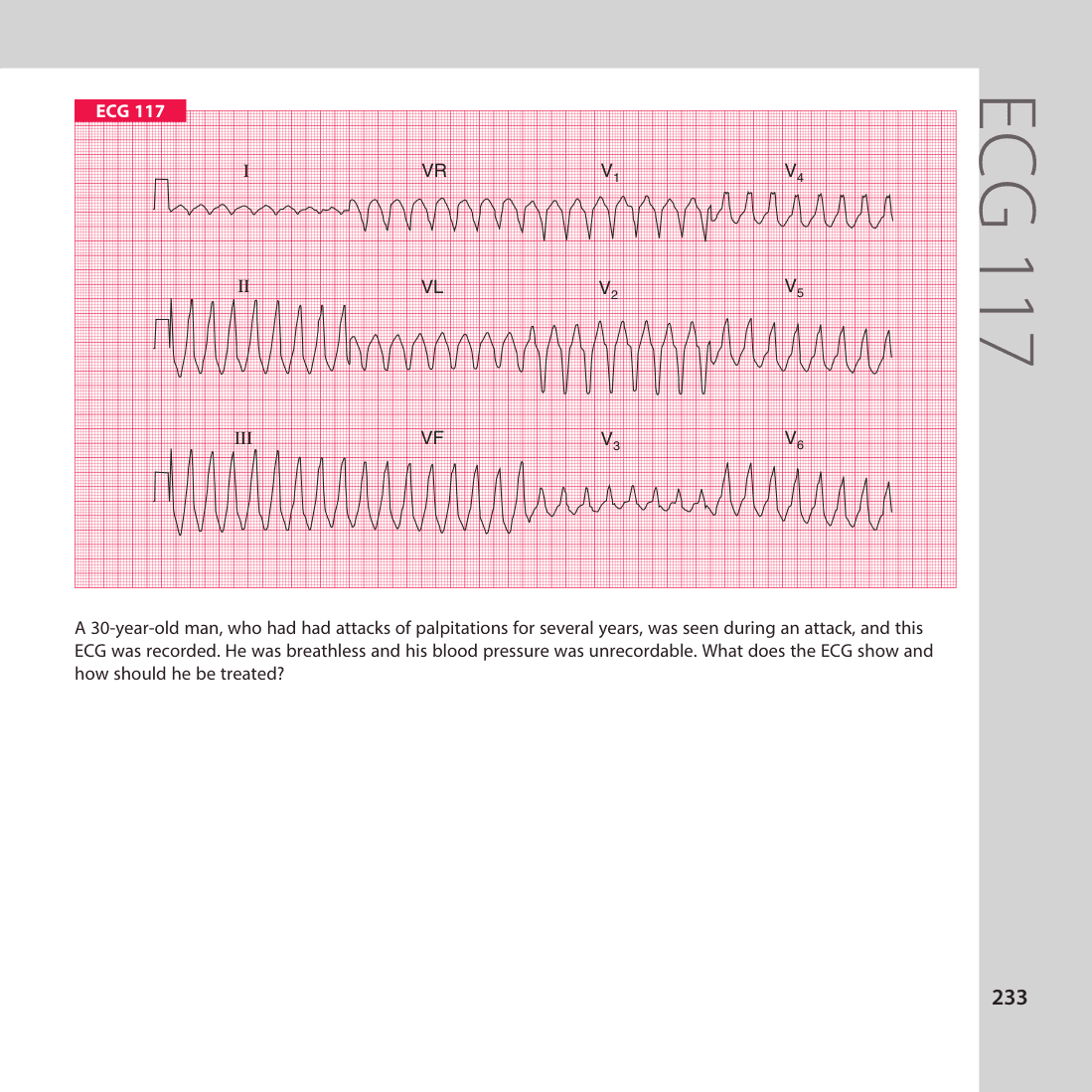 ECG 117