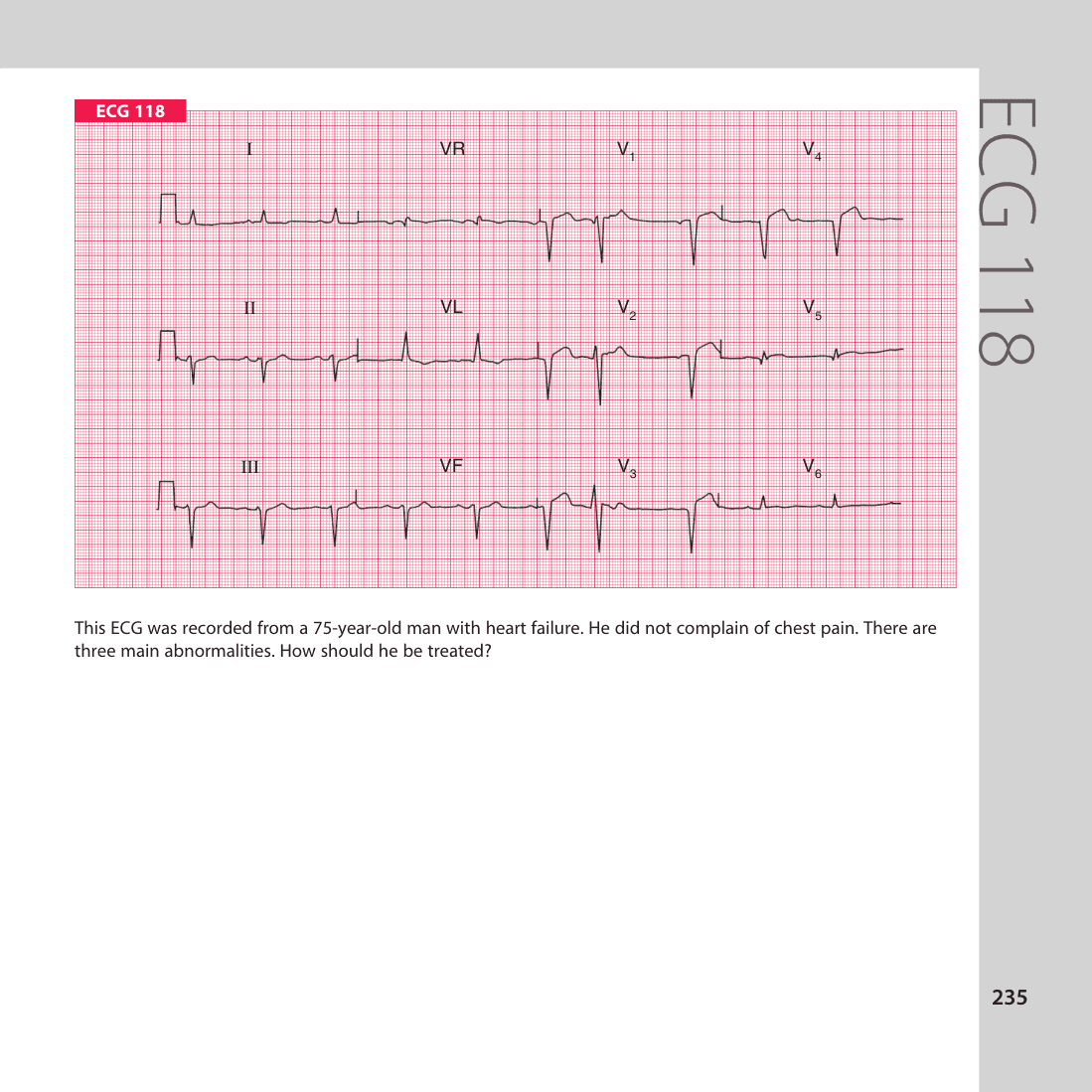 ECG 118