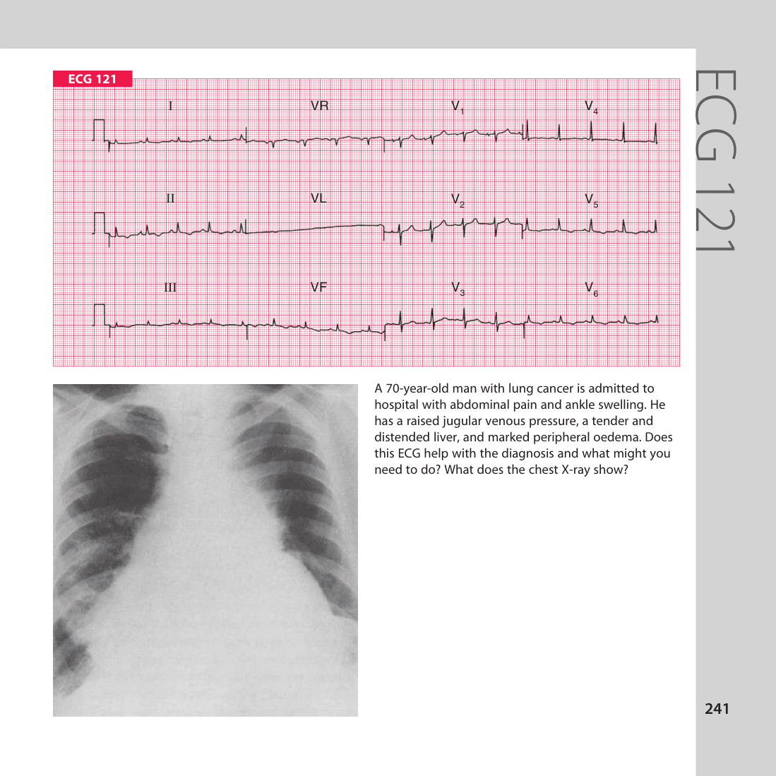 ECG 121