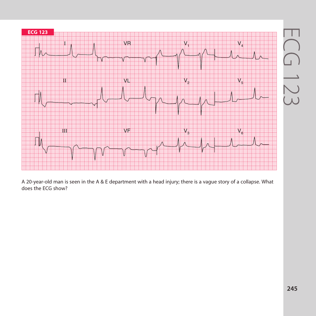 ECG 123