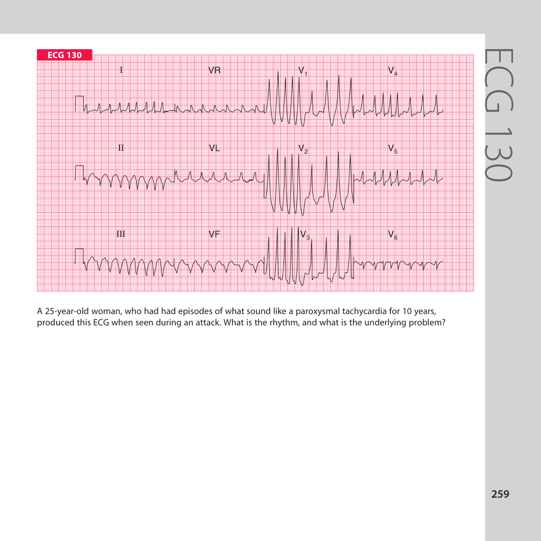 ECG 130