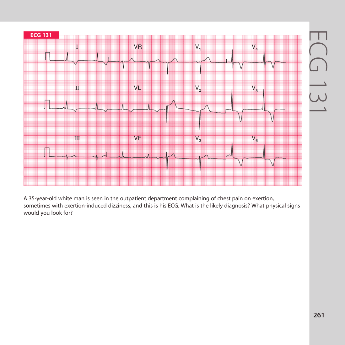 ECG 131