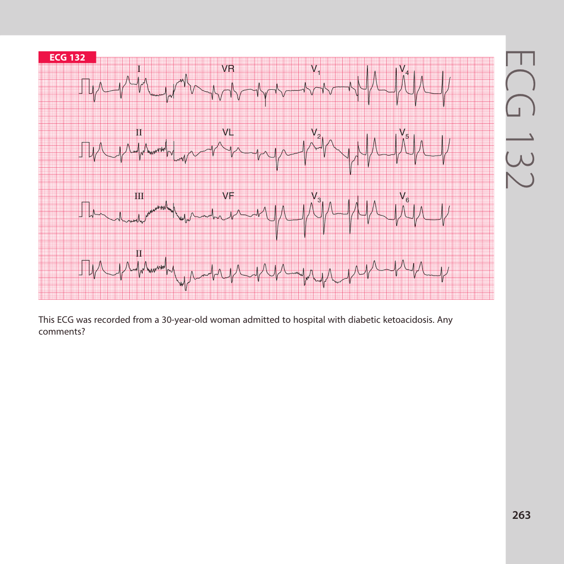 ECG 132