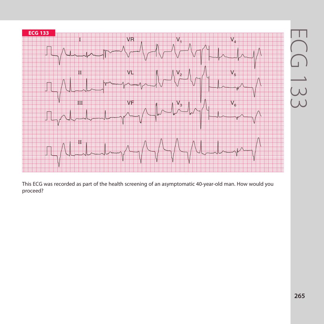 ECG 133
