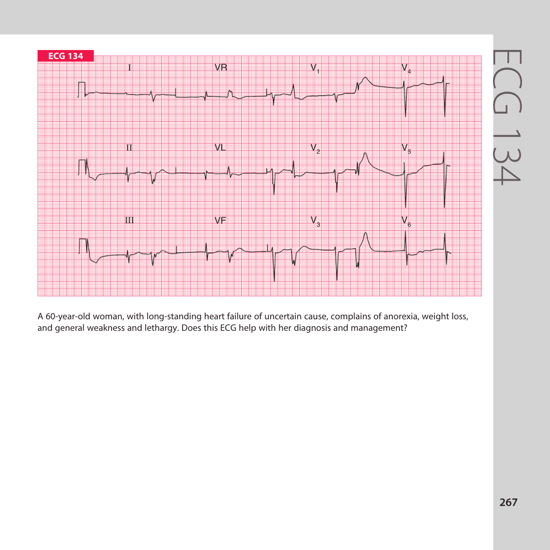 ECG 134